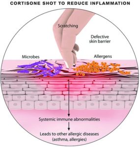 Cortisone Shots · Pain Specialist · 2021 Top Laser Dermatologist Nyc