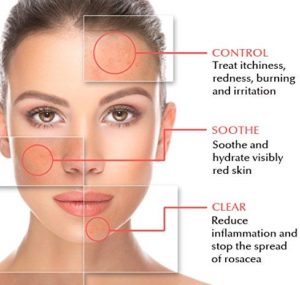 Rosacea Natural Treatment · Top Dermatology · Dermatologist NYC